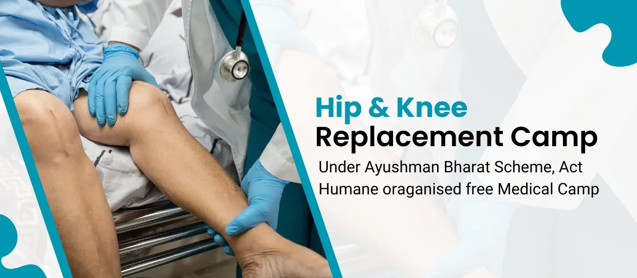 hip-and-knee-replacement-camp- (1)