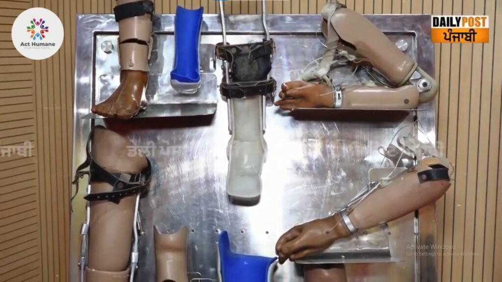 Act Humane Organizes Free Artificial Limb Camp, 2 Feb 2025