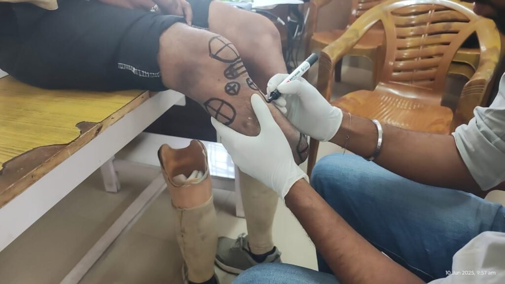 Limbs Measurement Camp at CHC Dharmpur Hospital, Himachal Pradesh