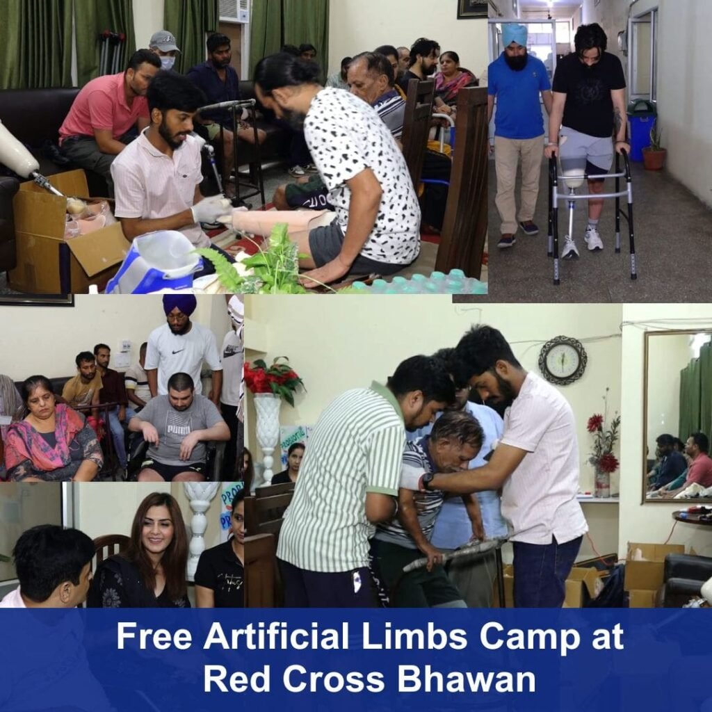 Free Artificial Limbs Camp at Red Cross Bhawan
