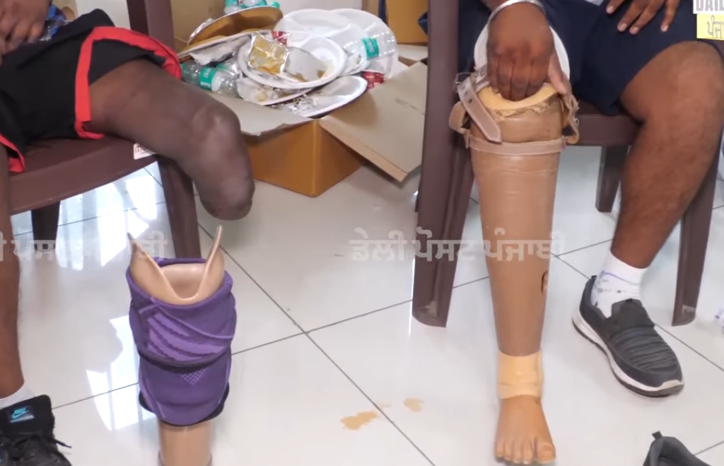 Act Humane Organises Free Artificial Limbs Camp in Chandigarh
