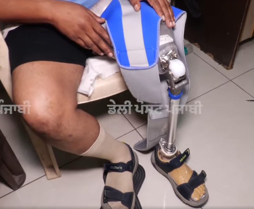 Act Humane Organises Free Artificial Limbs Camp in Chandigarh