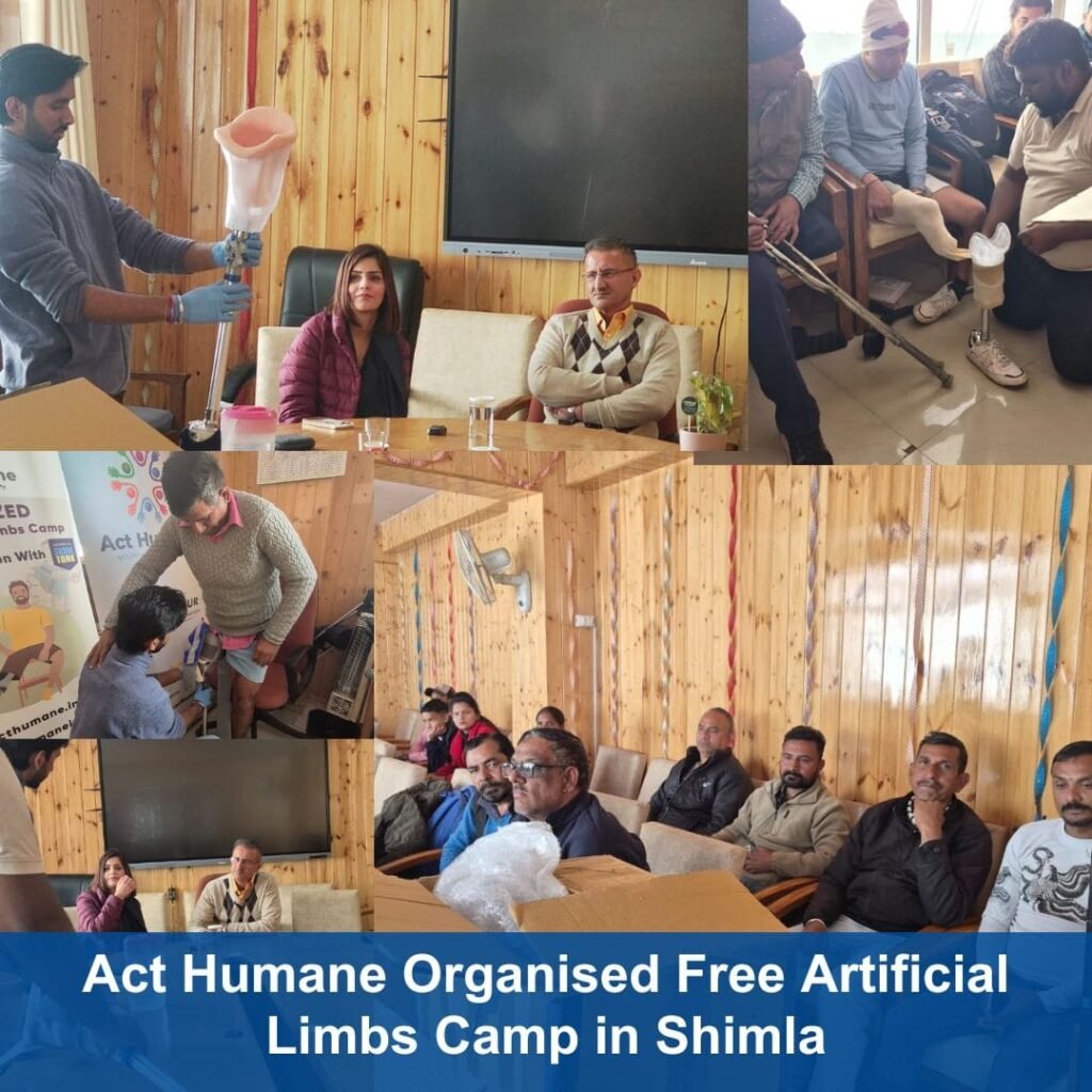 Free Artificial Limbs Camp in Shimla