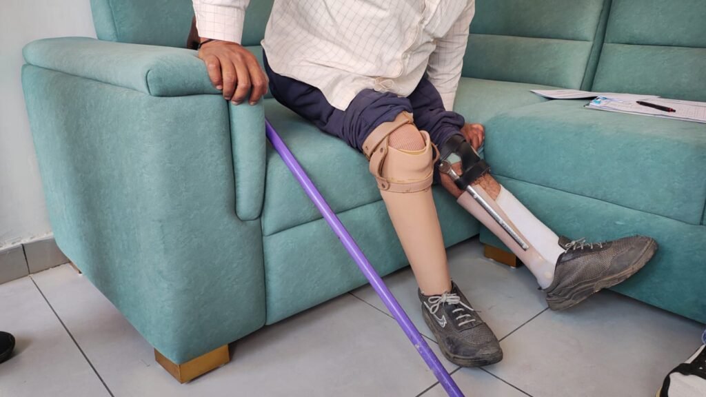 Free Artificial Limb Measurement Camp at Mandi, Himachal Pradesh
