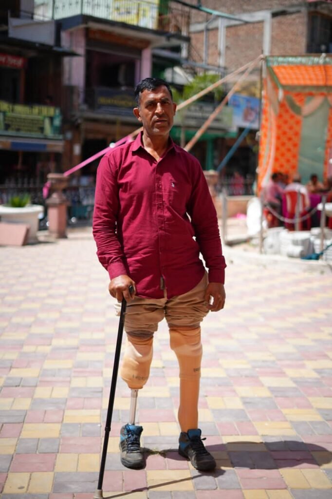 Free Artificial Limbs Camp in Himachal Pradesh by Act Humane