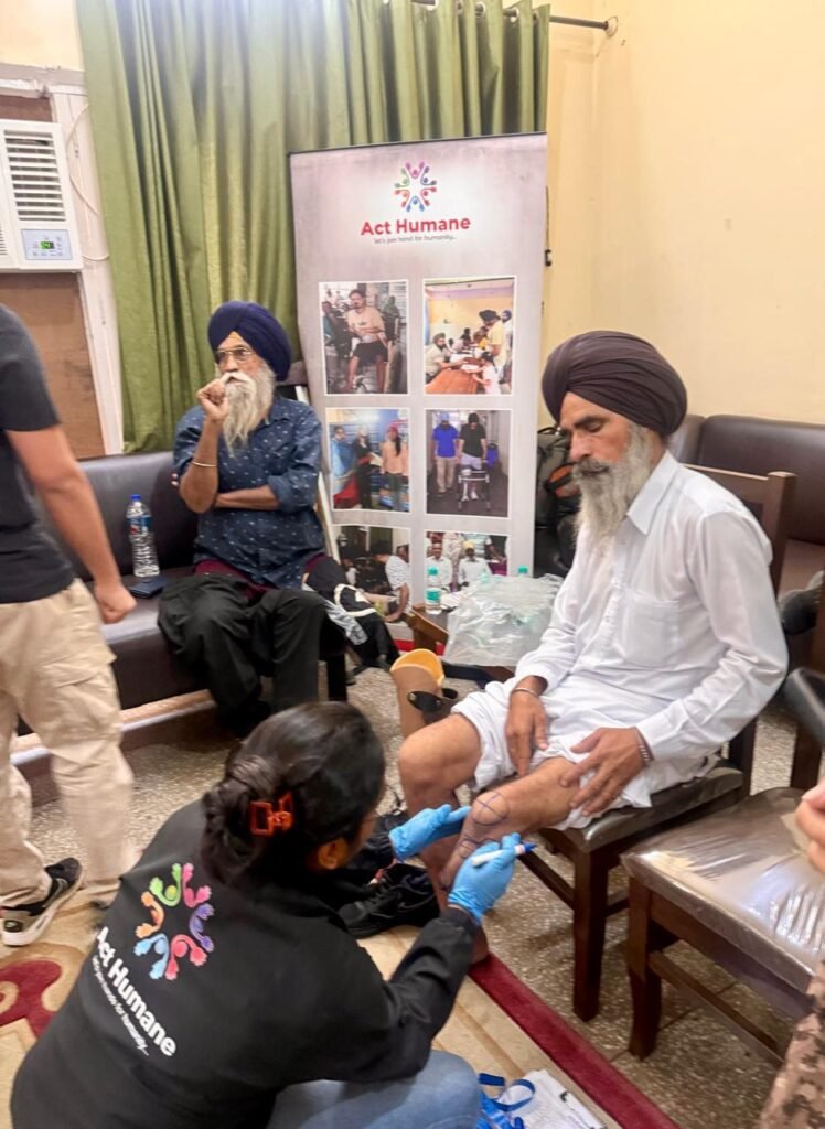 Free Artificial Limb Distribution and Fitment Camp Brings Mobility and Hope